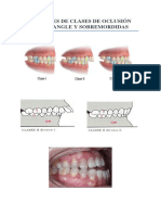 Analisis de Oclusion Dental