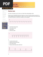 Ecg Quiz