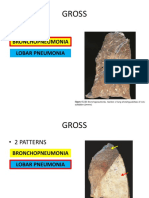 GROSS - Broncho & Lobar Pneumonia