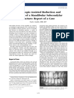 Endoscopic-Assisted Reduction and Fixation of a Mandibular Subcondylar Fracture Report of a Case