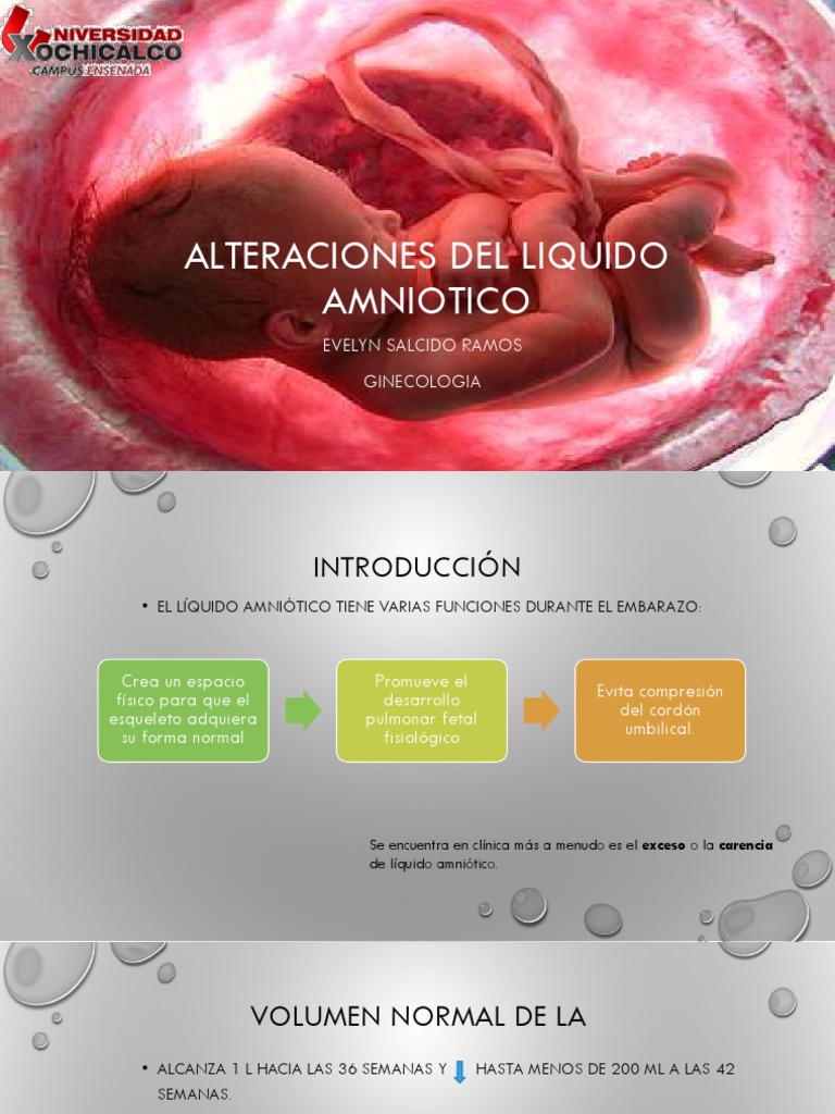 Alteraciones Del Liquido Amniotico El embarazo Parto