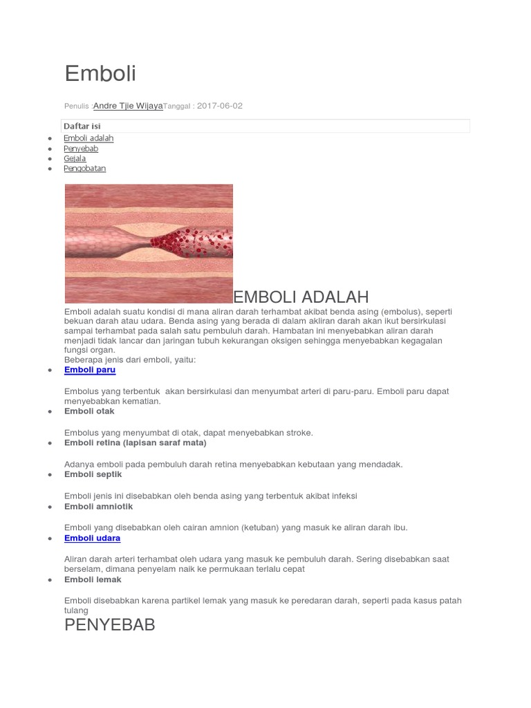 Emboli Pdf