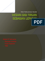 Desain Gigi Tiruan Sebagian Lepasan