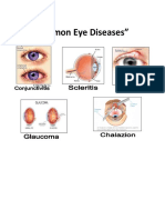 “Common Eye Diseases”
