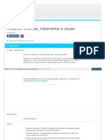 Melasma Sintoma Tratamento e Causas