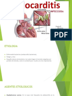 Endocarditis