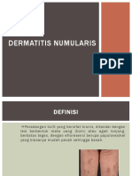Dermatitis Numularis 