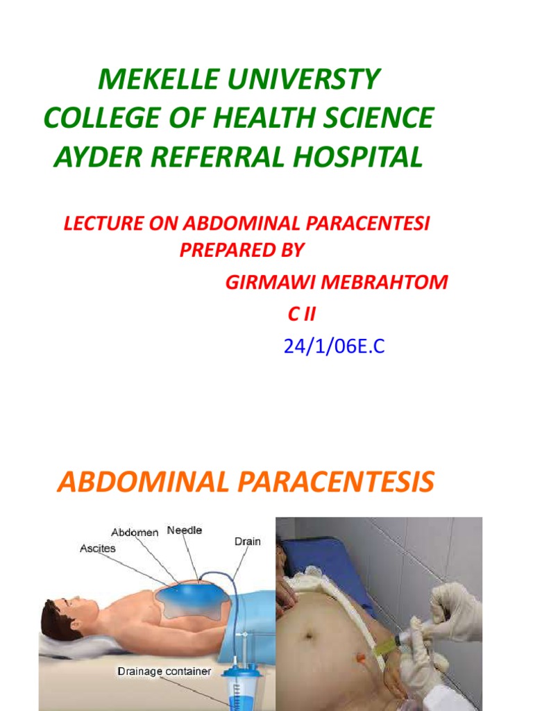 Abdominal Paracentesis Procedure Guide | PDF | Syringe | Diseases And ...