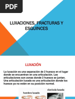 luxaciones