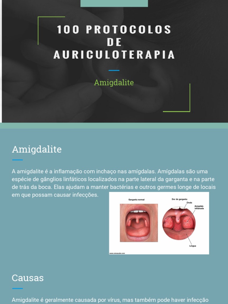 Causas e Sintomas da Amigdalite | PDF | Infecção | Especialidades médicas, image size:768x1024
