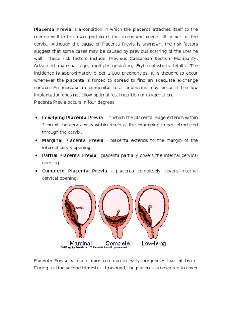 DR - Case Report Placenta Previa 3 | PDF | Placenta | Childbirth