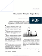 Circumcision Using The Mogen Clamp