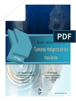 tumor maligno II.pdf
