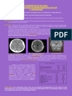Complicaciones de Meningoencefalitis Por s. Pneumoniae