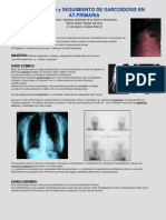 Diagnóstico y seguimiento de sarcoidosis en APS