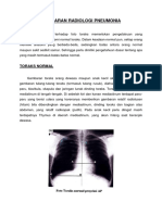 Gambaran Radiologi Pneumonia