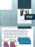 PPT Tof Radio