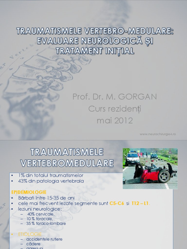 TVM Trat PDF | PDF