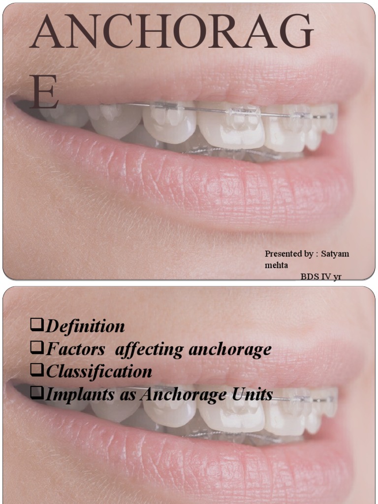 Anchorage in Orthodontics Explained | PDF | Tooth | Mouth