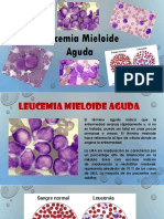 Leucemia Expo