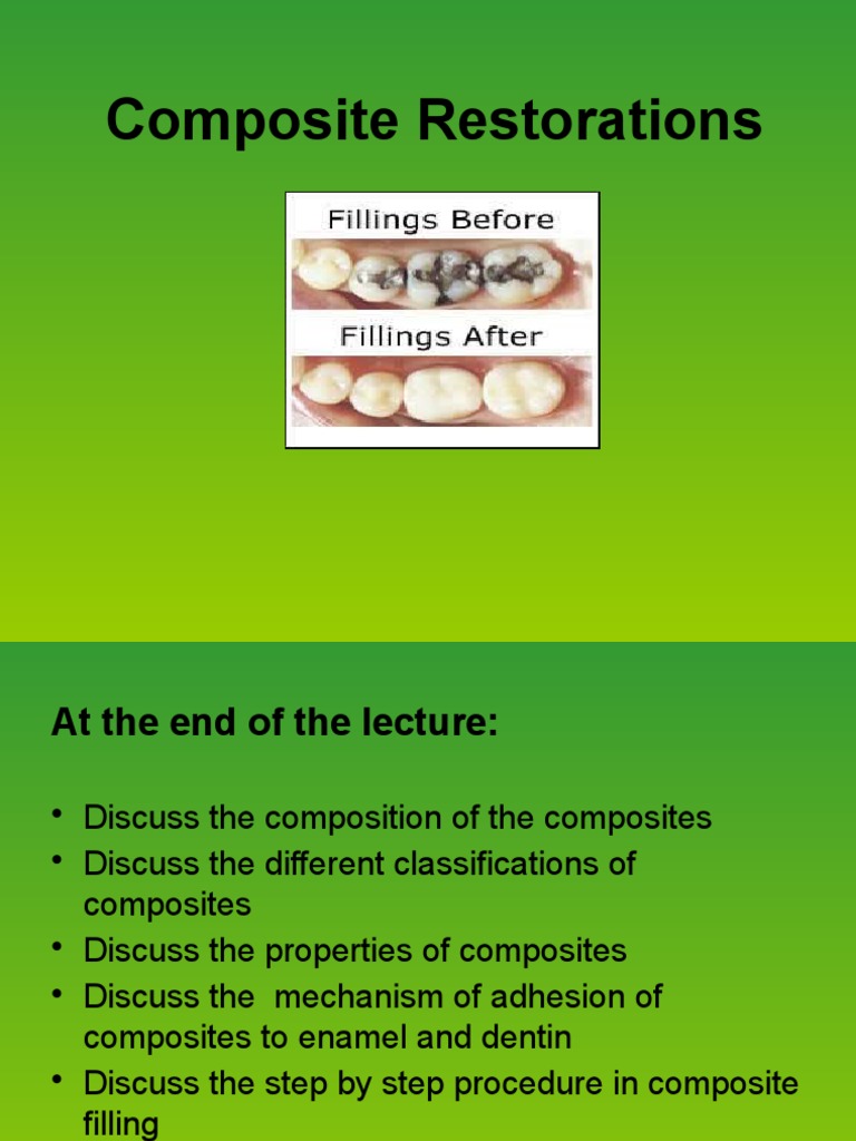 Composite Restoration PDF Dental Composite Composite Material
