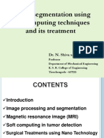 Tumor Segmentation Using Soft Computing Techniques and Its Treatment