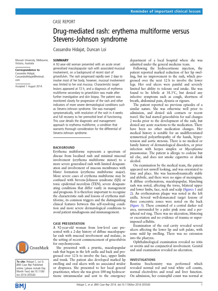Drug-Mediated Rash: Erythema Multiforme Versus Stevens-Johnson Syndrome ...