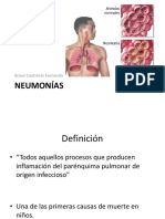 Neumonia