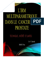 IRM Multiparamétrique Dans Le Cancer de La Prostate.