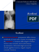 Scoliosi