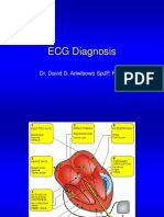 Ecg Diagnosis: Dr. David D. Ariwibowo SPJP, Fiha