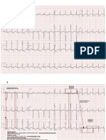 LP3ECG Exemple