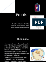 pulpitis1