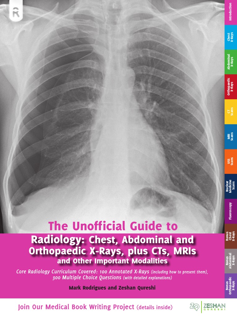 The Unofficial Guide To: Radiology | PDF | Ct Scan | Medical Imaging