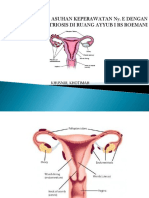 ppt endrometriosis.pptx