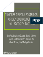 Tumores de Fosa Posterior