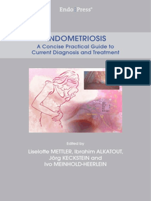 Endometriosis Karl Storz, PDF, Doctor Of Medicine