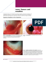 Conjunctival Disease