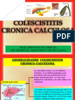 Colecistitis Cronica Calculosa