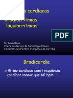 12 - Bradiarritmias