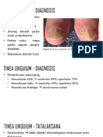 Tinea Unguium