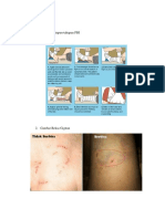 Gambar Gigitan Dan Penaganan PBI