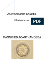 Acanthoamoeba Keratitis