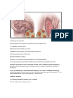 Virus Del Papiloma Humano