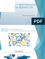 Diagnostico y Monitorizacion de La Epilepsia Mediante EEG