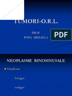 CURS ORL-TUMORI - Copy.ppt