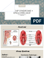 Croup Syndrome Epiglotitis Akut