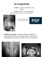 Anomalii-Congenitale Renale