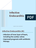 Infective Endocarditis