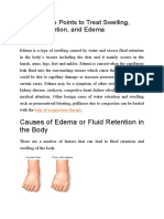 Acupressure Points to Treat Swelling&Edema
